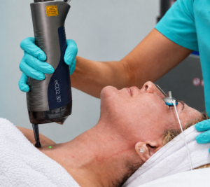 "eCO2 3D treatment at OLC"